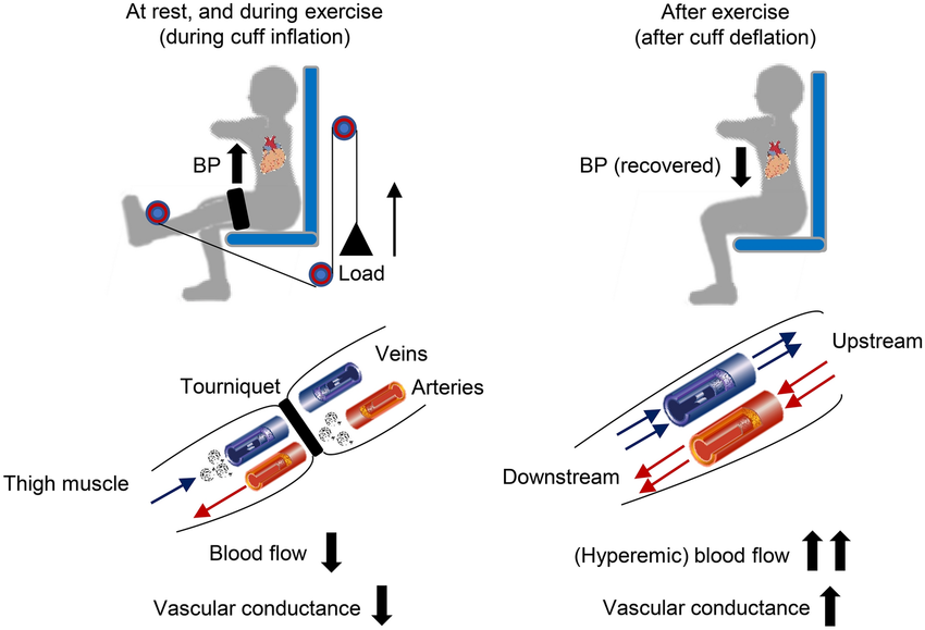 A-hypothetical-illustration-which-explains-hemodynamic-at-rest-during-exercise-and-after.png
