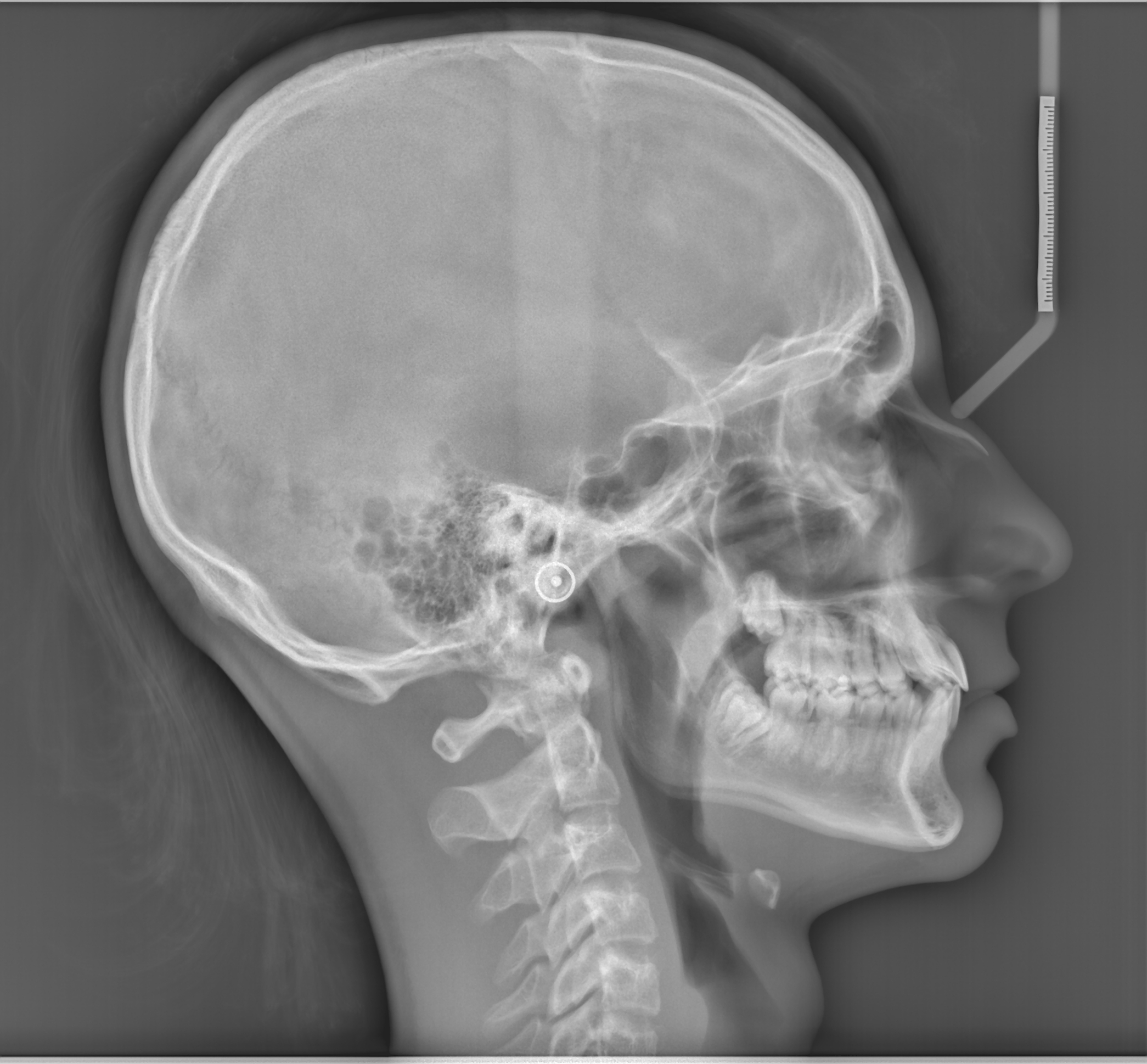 ceph calugar victor.jpg