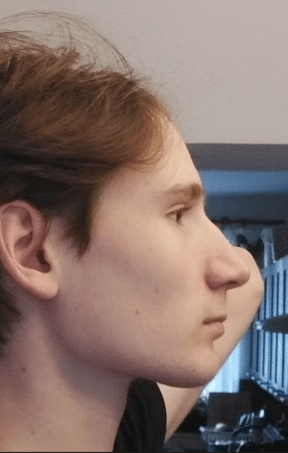 ezgif.com-speed (2).gif